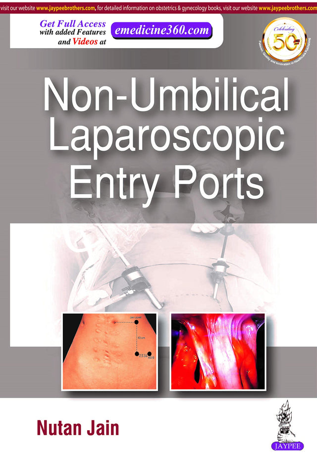 NON-UMBILICAL LAPAROSCOPIC ENTRY PORTS - Retail Maharaj