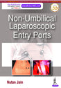 NON-UMBILICAL LAPAROSCOPIC ENTRY PORTS - Retail Maharaj
