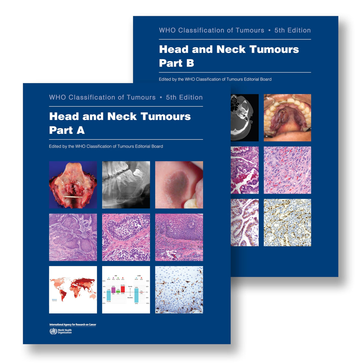 Head and Neck Tumours: Who Classification of Tumours (World Health Organization Classification of Tumours) - Retail Maharaj