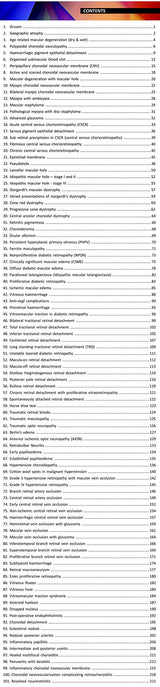 Retina Cases Illustrated - Retail Maharaj