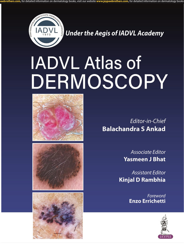 IADVL Atlas of Dermoscopy - Retail Maharaj