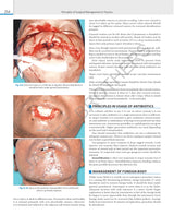 SRB'S SURGICAL OPERATION TEXT AND ATLAS (2 VOLS) - Retail Maharaj
