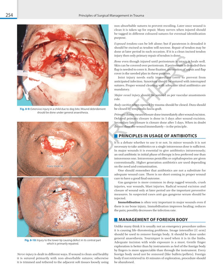 SRB'S SURGICAL OPERATION TEXT AND ATLAS (2 VOLS) - Retail Maharaj