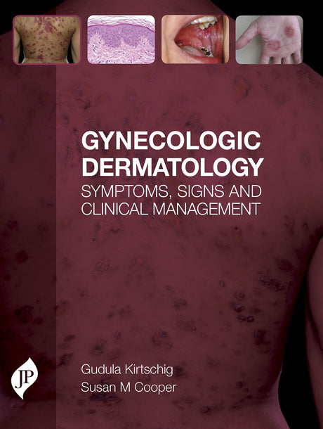GYNECOLOGIC DERMATOLOGY SYMPTOMS, SIGNS AND CLINICAL MANAGEMENT - Retail Maharaj