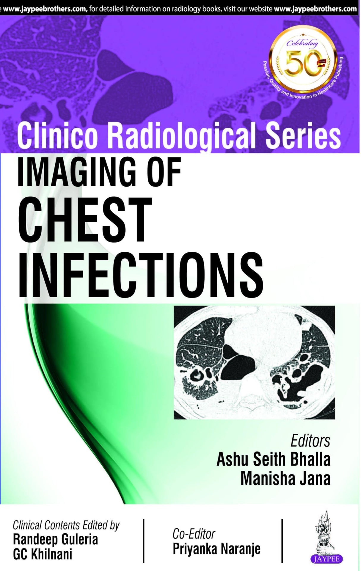 Clinico Radiological Series: Imaging of Chest Infections - Retail Maharaj