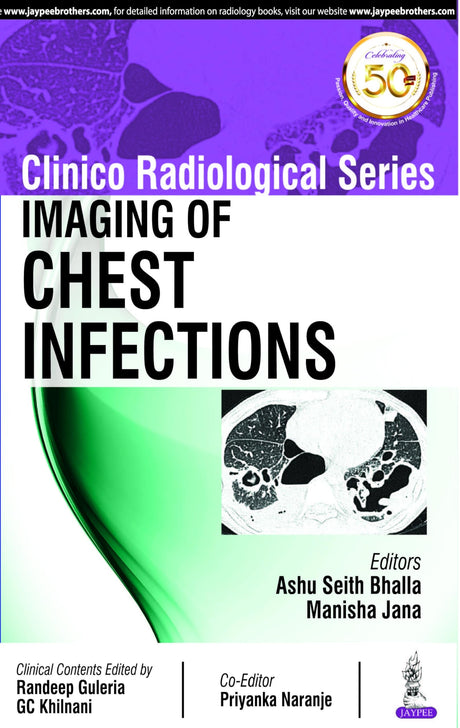Clinico Radiological Series: Imaging of Chest Infections - Retail Maharaj