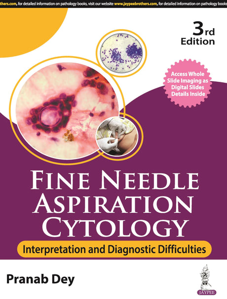 FINE NEEDLE ASPIRATION CYTOLOGY: INTERPRETATION AND DIAGNOSTIC DIFFICULTIES - Retail Maharaj
