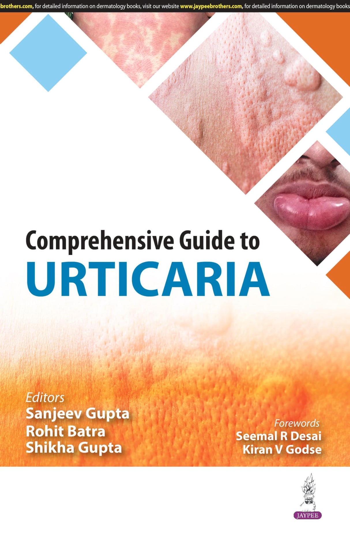 COMPREHENSIVE GUIDE TO URTICARIA - Retail Maharaj