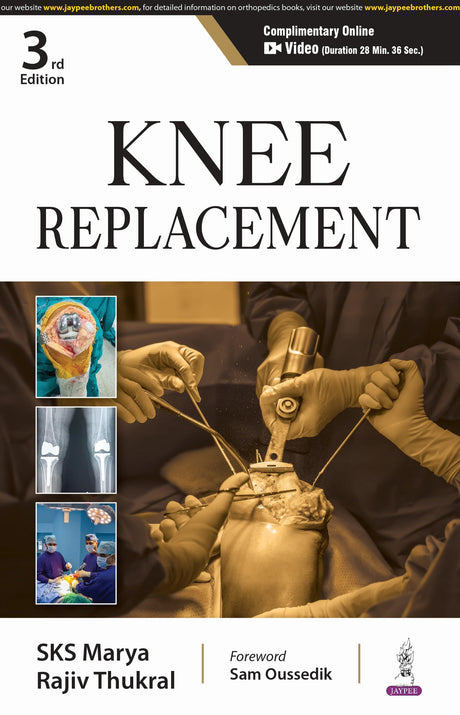 KNEE REPLACEMENT - Retail Maharaj