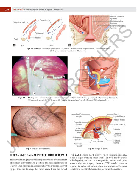 Textbook of Laparoscopy for Surgeons and Gynecologists - Retail Maharaj