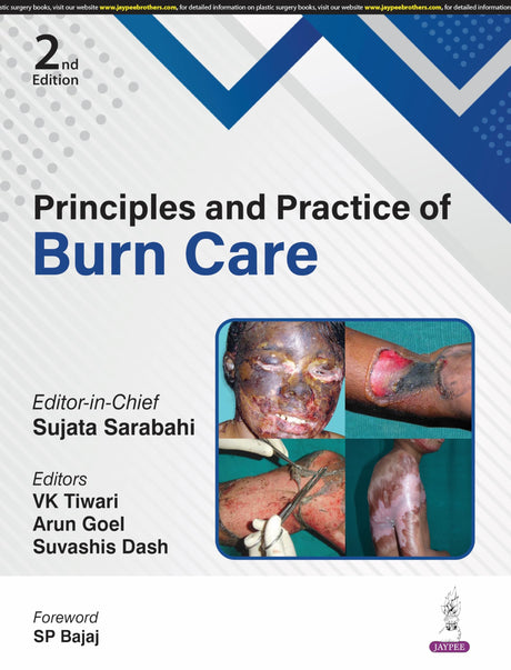PRINCIPLES AND PRACTICE OF BURN CARE - Retail Maharaj