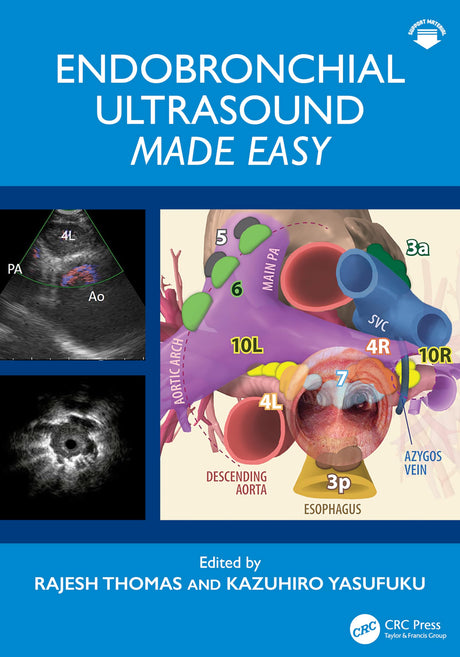 Endobronchial Ultrasound Made Easy: Made Easy - Retail Maharaj
