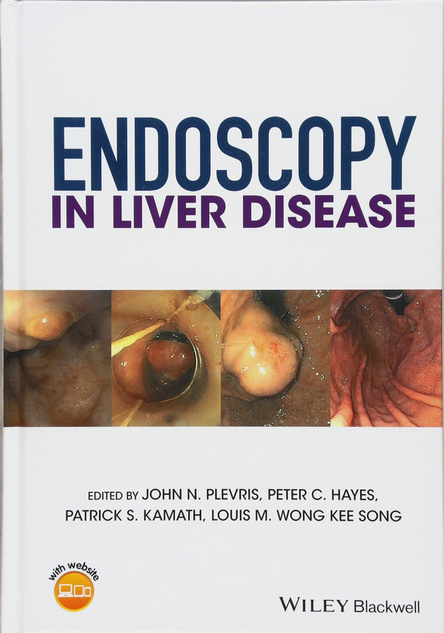 Endoscopy In Liver Disease (Hb 2018) - Retail Maharaj
