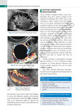 PRACTICAL GUIDE TO INTRAUTERINE INSEMINATION (IUI) - Retail Maharaj