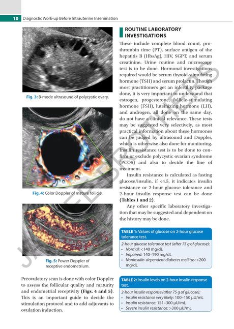 PRACTICAL GUIDE TO INTRAUTERINE INSEMINATION (IUI) - Retail Maharaj