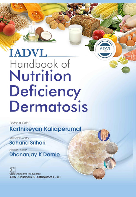 IADVL Handbook Of Nutrition Deficiency Dermatosis - Retail Maharaj