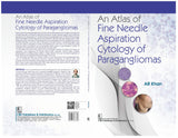 An Atlas of Fine Needle Aspiration Cytology of Paragangliomas - Retail Maharaj