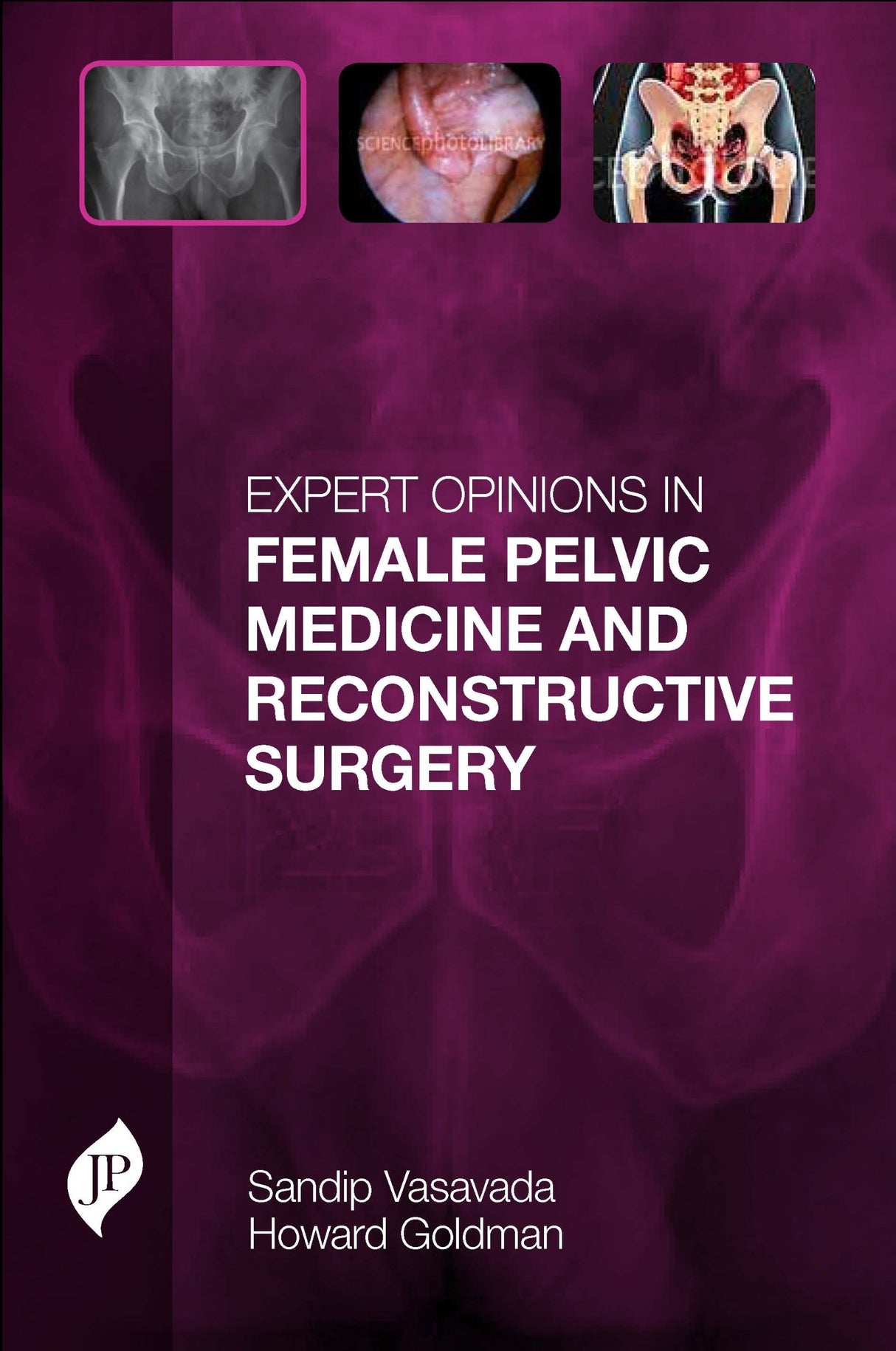 Expert Opinions in Female Pelvic Medicine and Reconstructive Surgery - Retail Maharaj