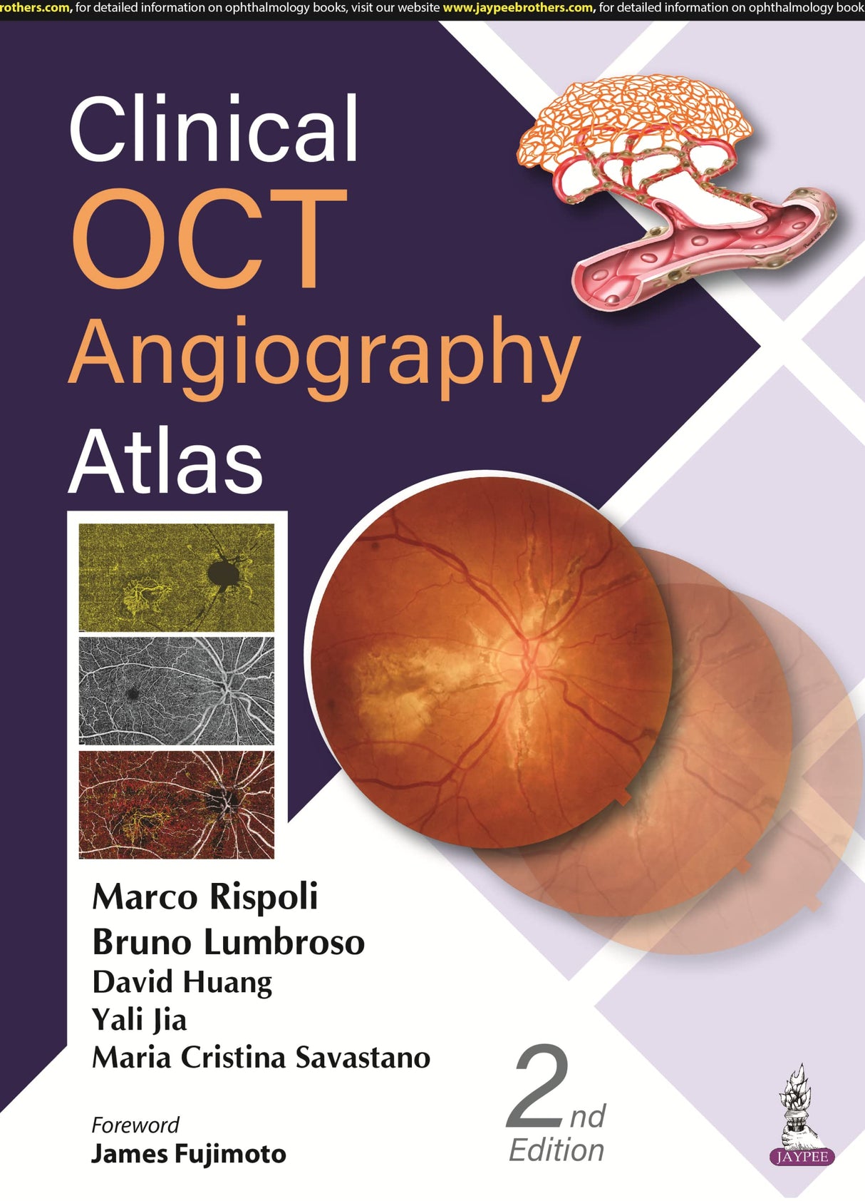 Clinical OCT Angiography Atlas - Retail Maharaj
