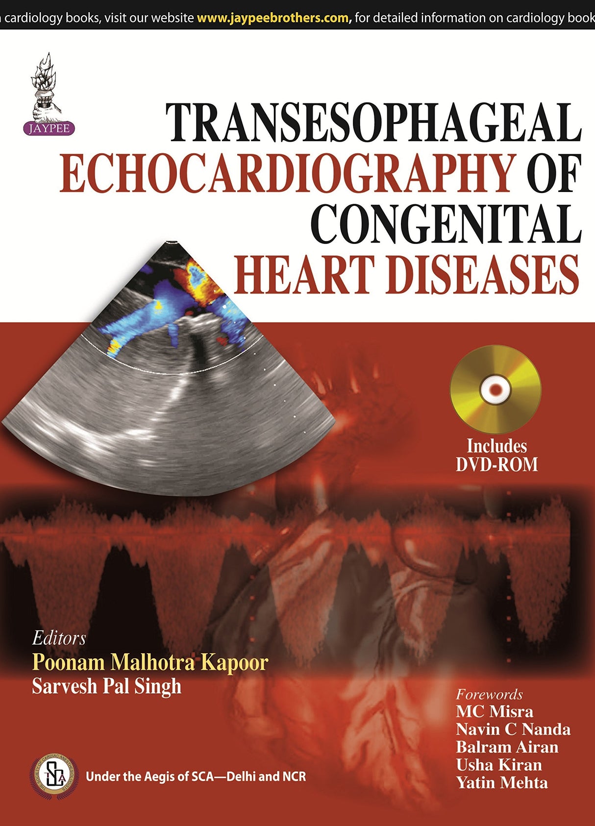 TRANSESOPHAGEAL ECHOCARDIOGRAPHY OF CONGENITAL HEART DISEASES - Retail Maharaj