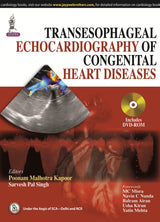 TRANSESOPHAGEAL ECHOCARDIOGRAPHY OF CONGENITAL HEART DISEASES - Retail Maharaj