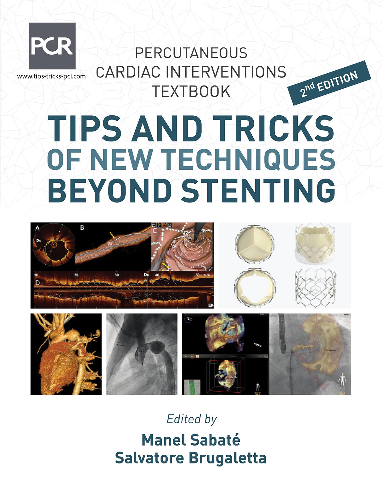 Percutaneous Cardiac Intervention Textbook- Tips and Tricks of New Techniques Beyond Stenting - Retail Maharaj