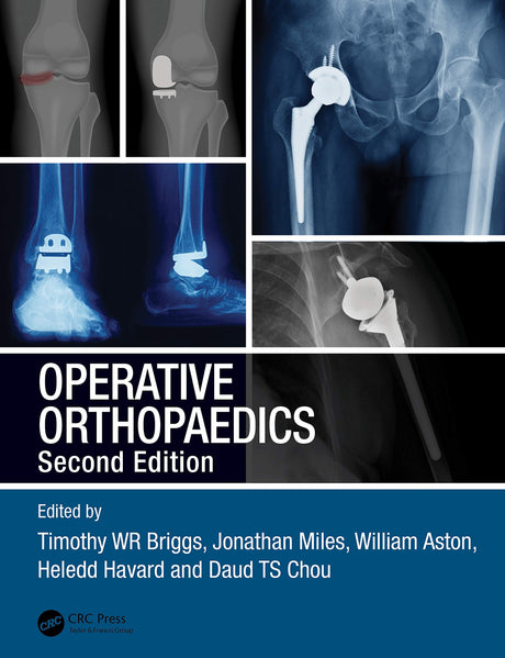 Operative Orthopaedics 2Ed (Pb 2021): The Stanmore Guide - Retail Maharaj