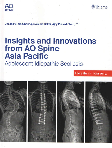 Insights and Innovations from AO Spine Asia Pacific: Adolescent Idiopathic Scoliosis - Retail Maharaj