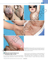 COLOR ATLAS & SYNOPSIS OF PEDIATRIC DERMATOLOGY - Retail Maharaj
