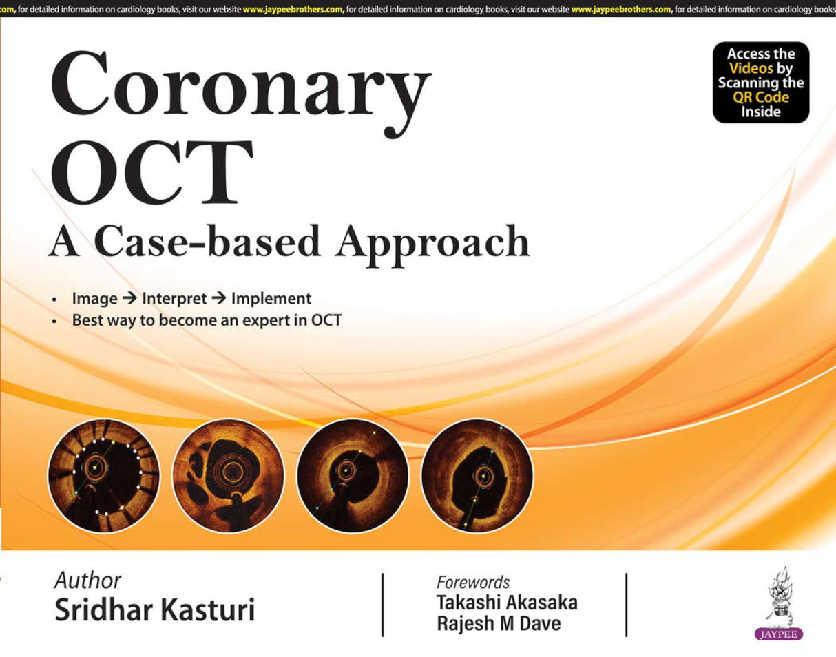 CORONARY OCT A CASE-BASED APPROACH - Retail Maharaj