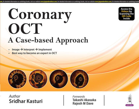 CORONARY OCT A CASE-BASED APPROACH - Retail Maharaj