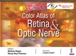 Color Atlas of Retina & Optic Nerve - Retail Maharaj