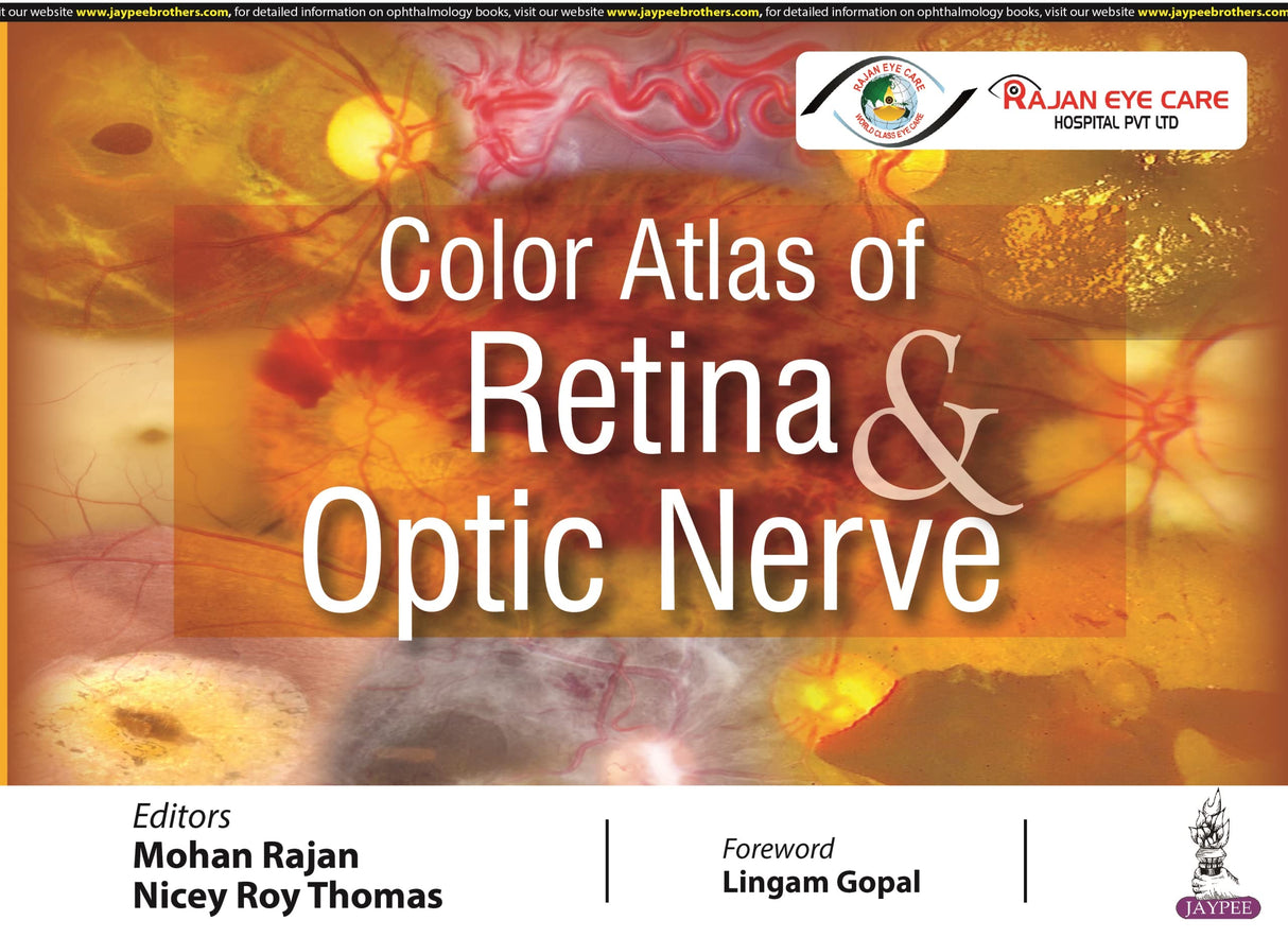 Color Atlas of Retina & Optic Nerve - Retail Maharaj