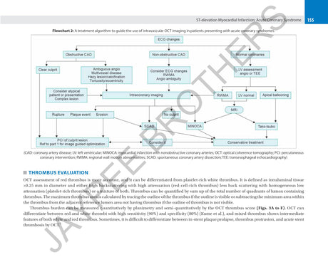 CORONARY OCT A CASE-BASED APPROACH - Retail Maharaj
