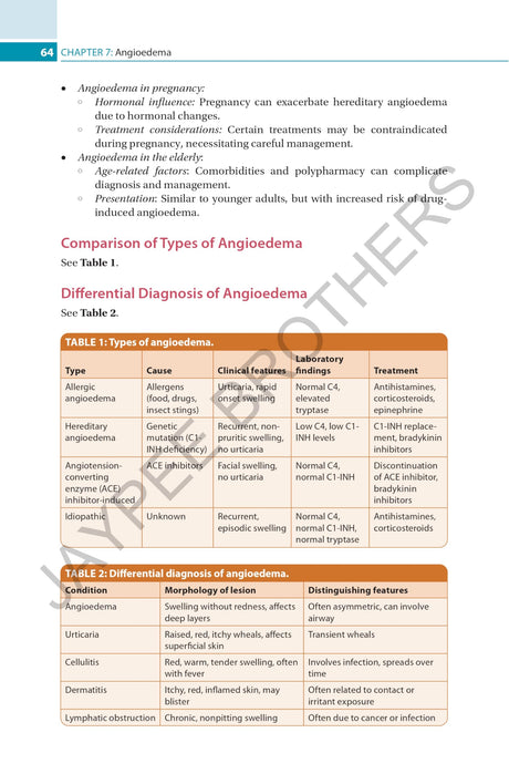 COMPREHENSIVE GUIDE TO URTICARIA - Retail Maharaj