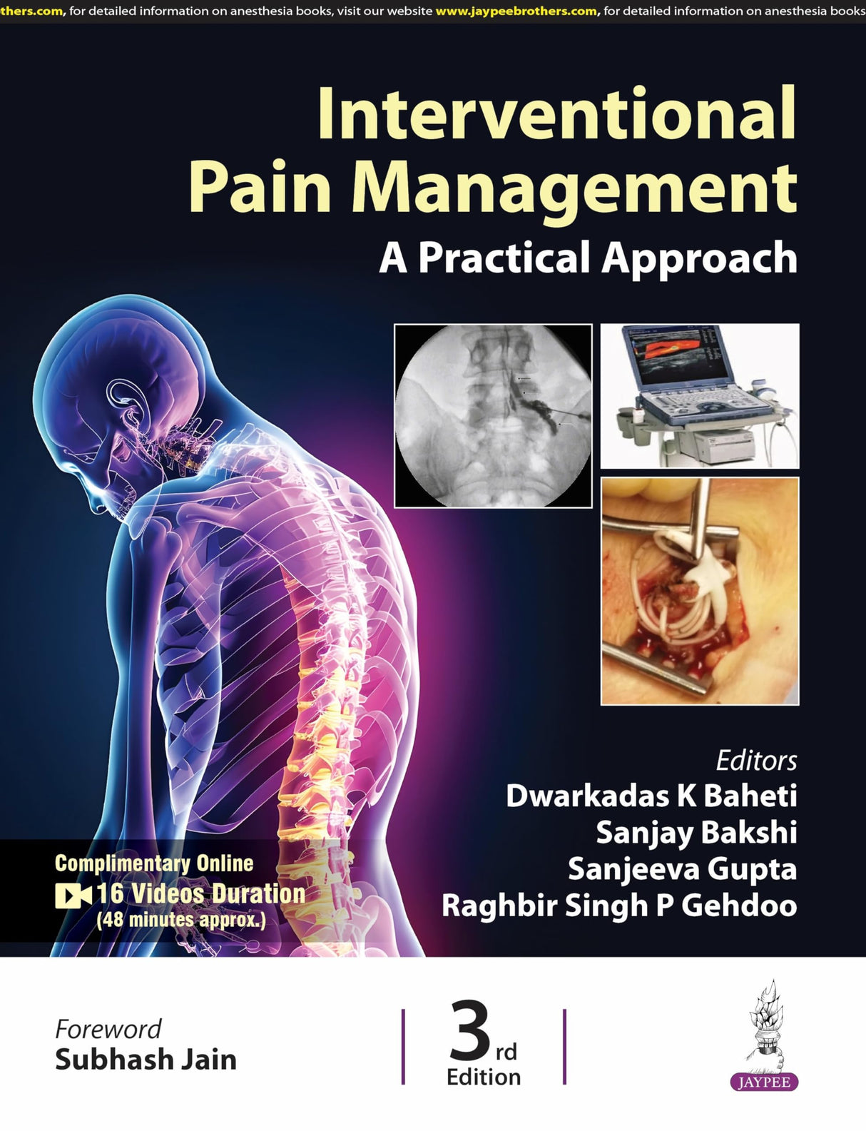 INTERVENTIONAL PAIN MANAGEMENT A PRACTICAL APPROACH - Retail Maharaj