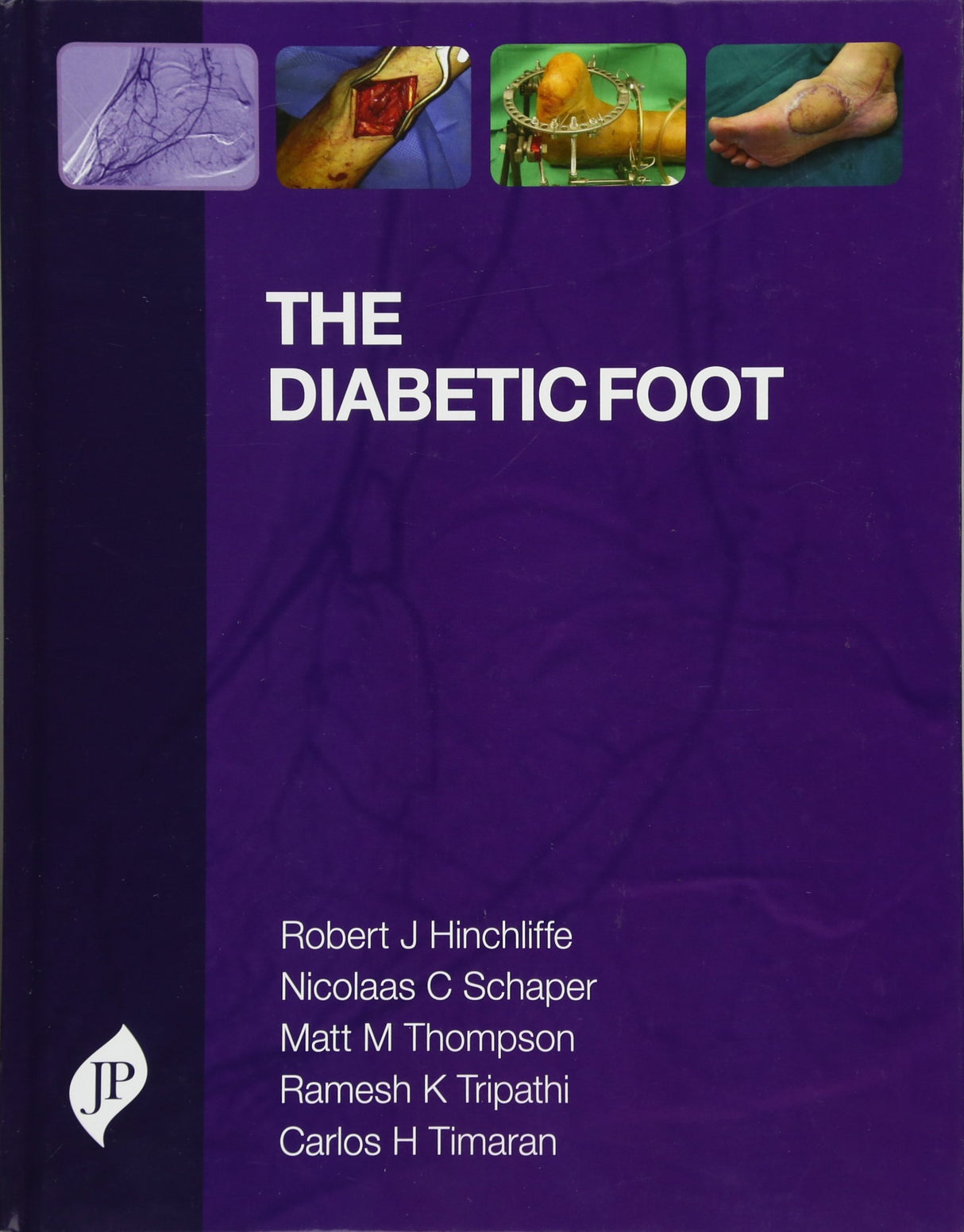 THE DIABETIC FOOT - Retail Maharaj