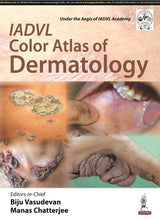 IADVL Color Atlas of Dermatology - Retail Maharaj