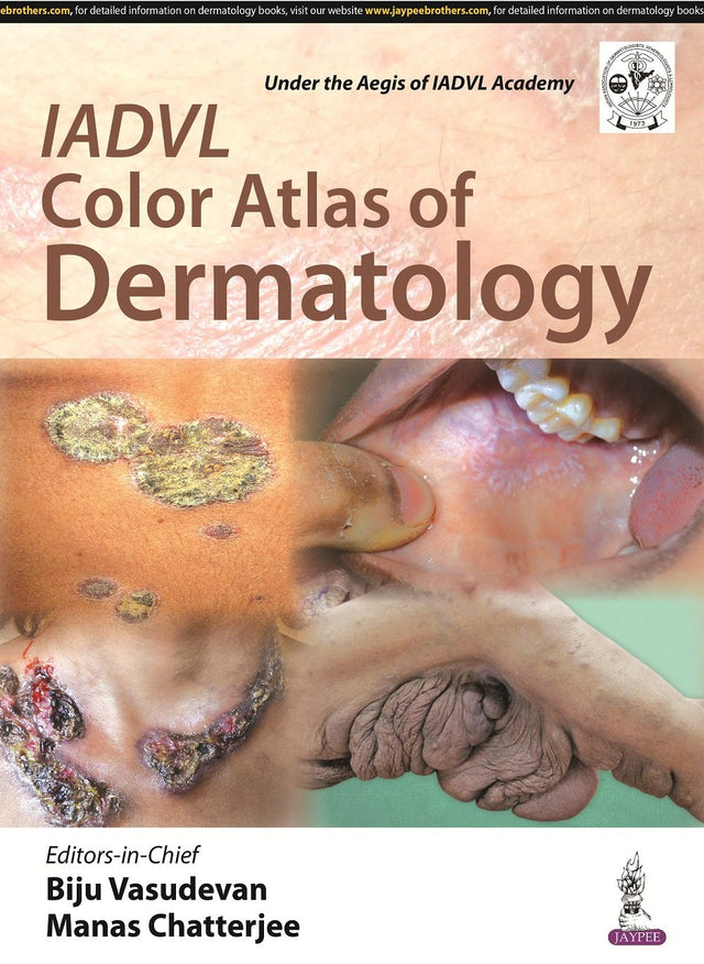 IADVL Color Atlas of Dermatology - Retail Maharaj