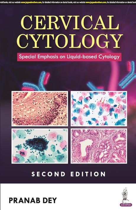 CERVICAL CYTOLOGY: SPECIAL EMPHASIS ON LIQUID-BASED CYTOLOGY - Retail Maharaj