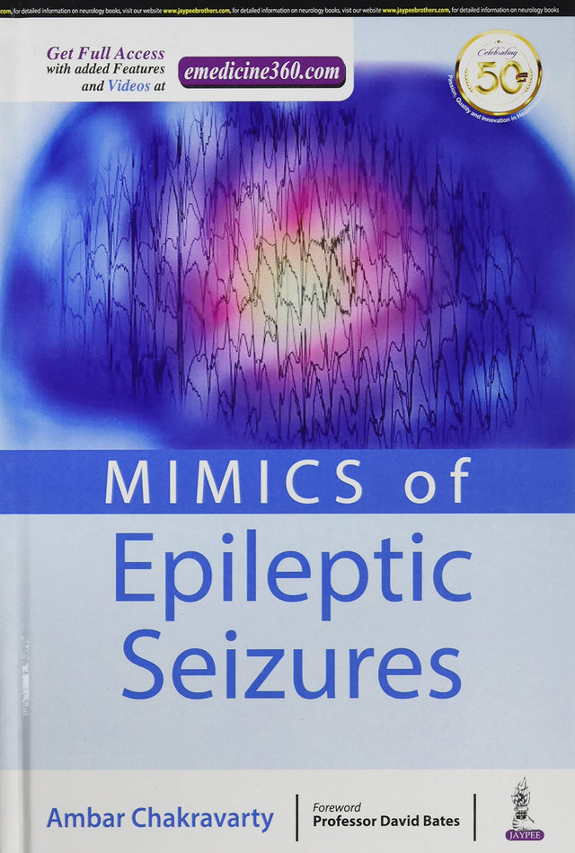 MIMICS OF EPILEPTIC SEIZURES - Retail Maharaj