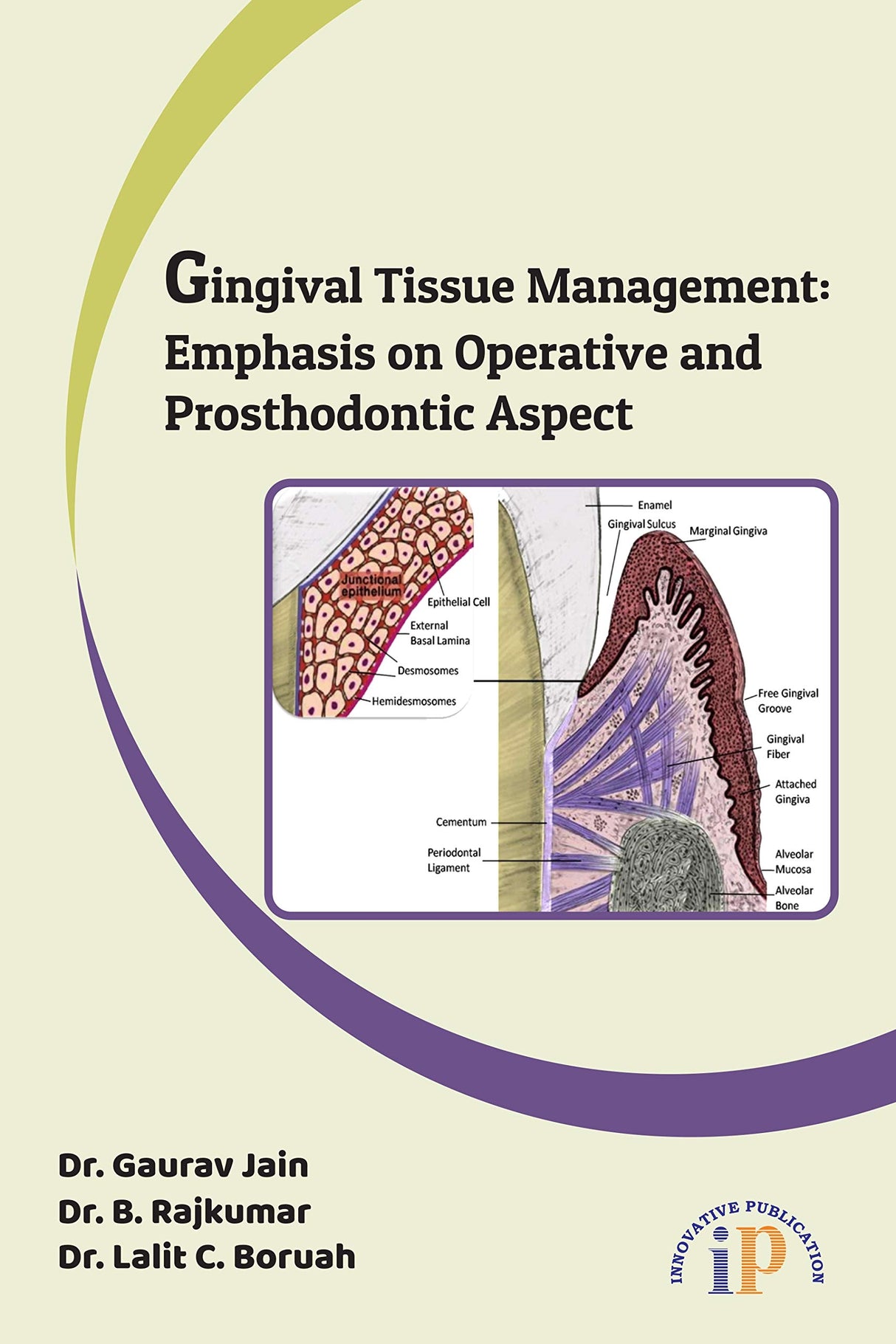 Gingival Tissue Management: Emphasis on Operative and Prosthodontic Aspect, Dec 2019, Operative Dentistry Books - Retail Maharaj