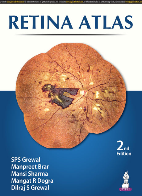 Retina Atlas - Retail Maharaj