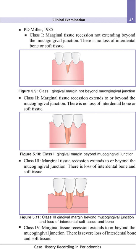 Case History Recording In Periodontology, Divya Bhat - 2nd, 2017.0 - Retail Maharaj