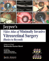 Jaypee Video Atlas Of Minimally Invasive Vitreoretinal Surgery - Retail Maharaj