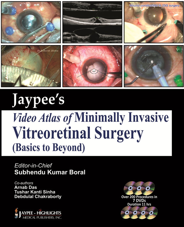 Jaypee Video Atlas Of Minimally Invasive Vitreoretinal Surgery - Retail Maharaj