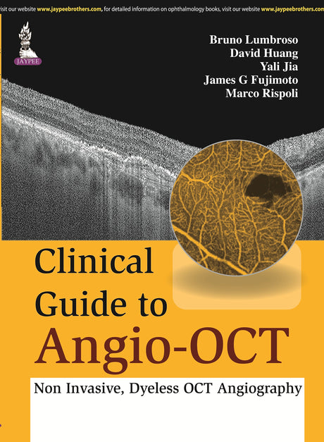 CLINICAL GUIDE TO ANGIO-OCT: NON INVASIVE,DYELESS OCT ANGIOGRAPHY - Retail Maharaj