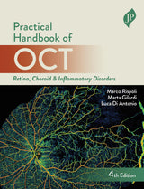 PRACTICAL HANDBOOK OF OCT RETINA, CHOROID & INFLAMMATORY DISORDERS - Retail Maharaj