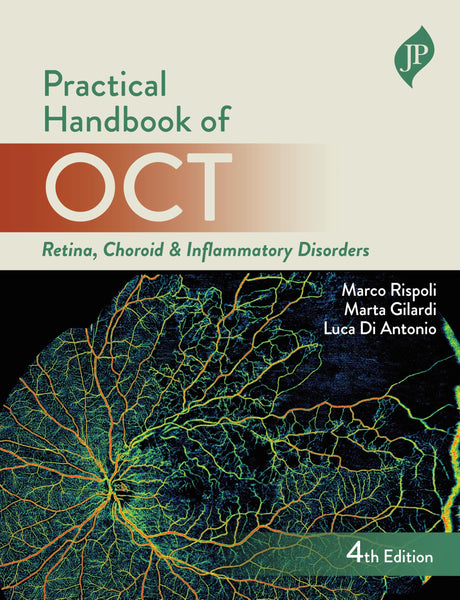 PRACTICAL HANDBOOK OF OCT RETINA, CHOROID & INFLAMMATORY DISORDERS - Retail Maharaj