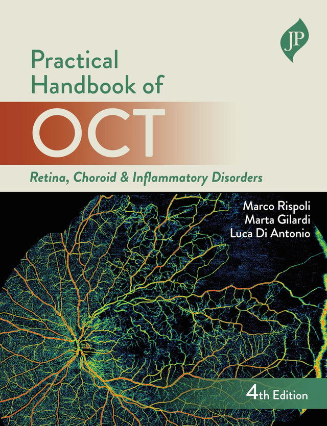 PRACTICAL HANDBOOK OF OCT RETINA, CHOROID & INFLAMMATORY DISORDERS - Retail Maharaj